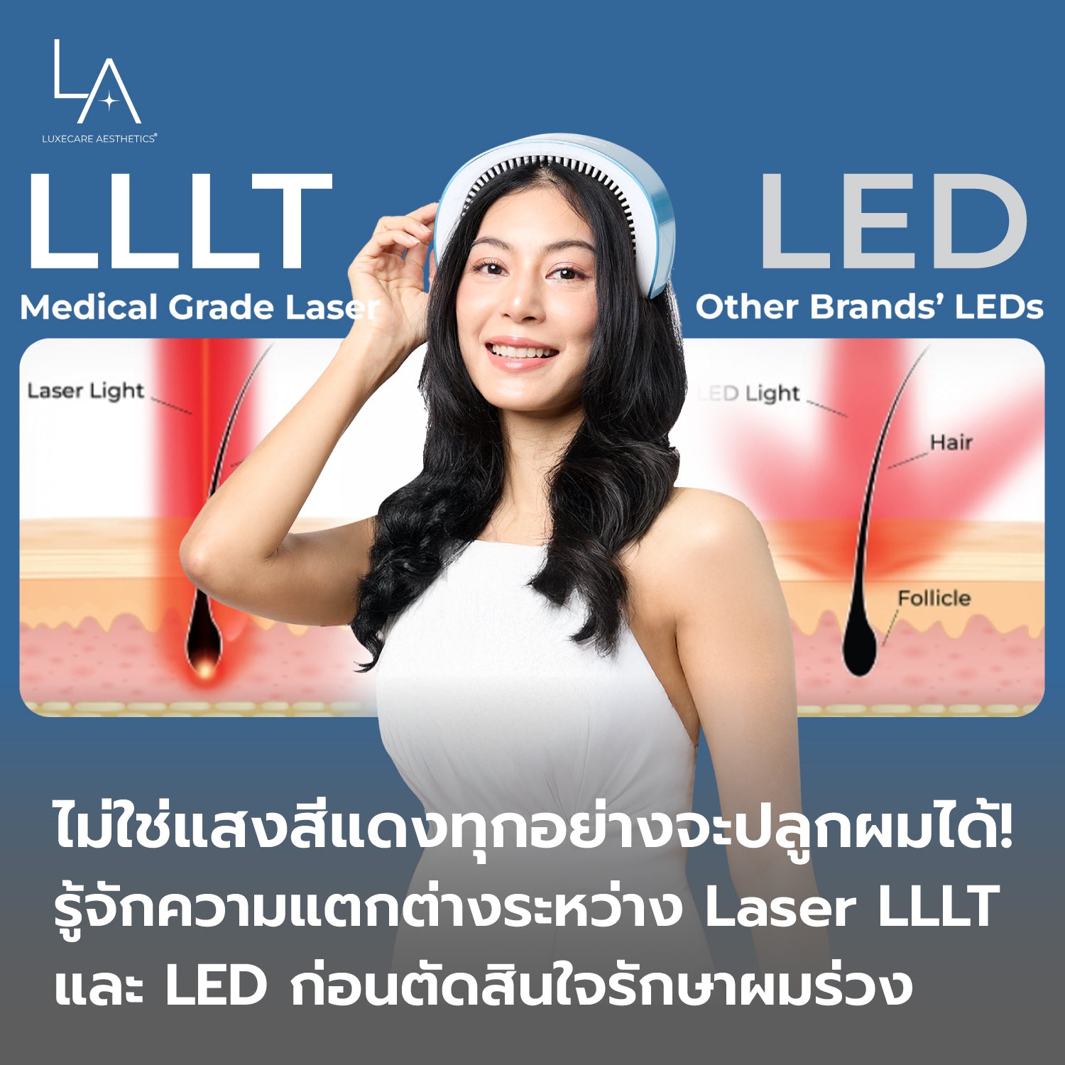 ไม่ใช่แสงสีแดงทุกอย่างจะปลูกผมได้! รู้จักความแตกต่างระหว่าง Laser LLLT และ LED ก่อนตัดสินใจรักษาผมร่วง
