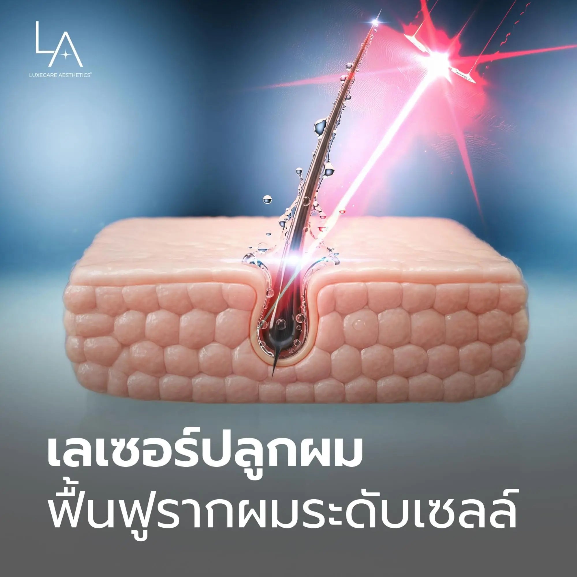 เลเซอร์ปลูกผมช่วยฟื้นฟูรากผมลึกถึงระดับเซลล์
