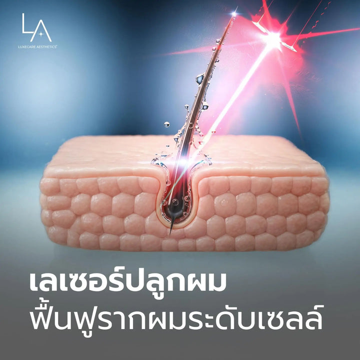 เลเซอร์ปลูกผมช่วยฟื้นฟูรากผมลึกถึงระดับเซลล์