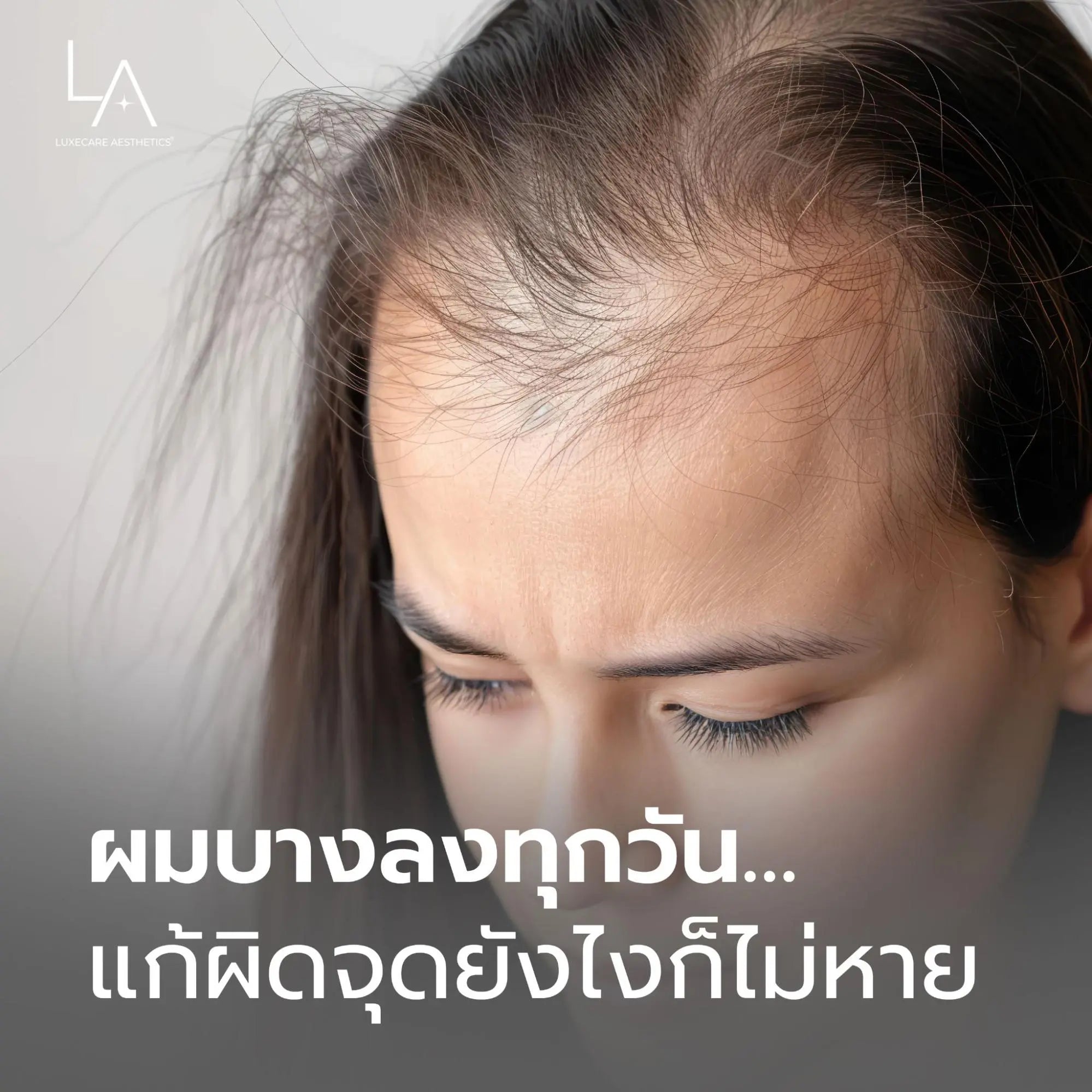 ผมบางลงทุกวัน…คุณกำลังแก้ผิดจุดอยู่หรือเปล่า?